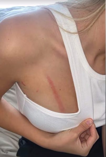 chiara e alfonso aggressione